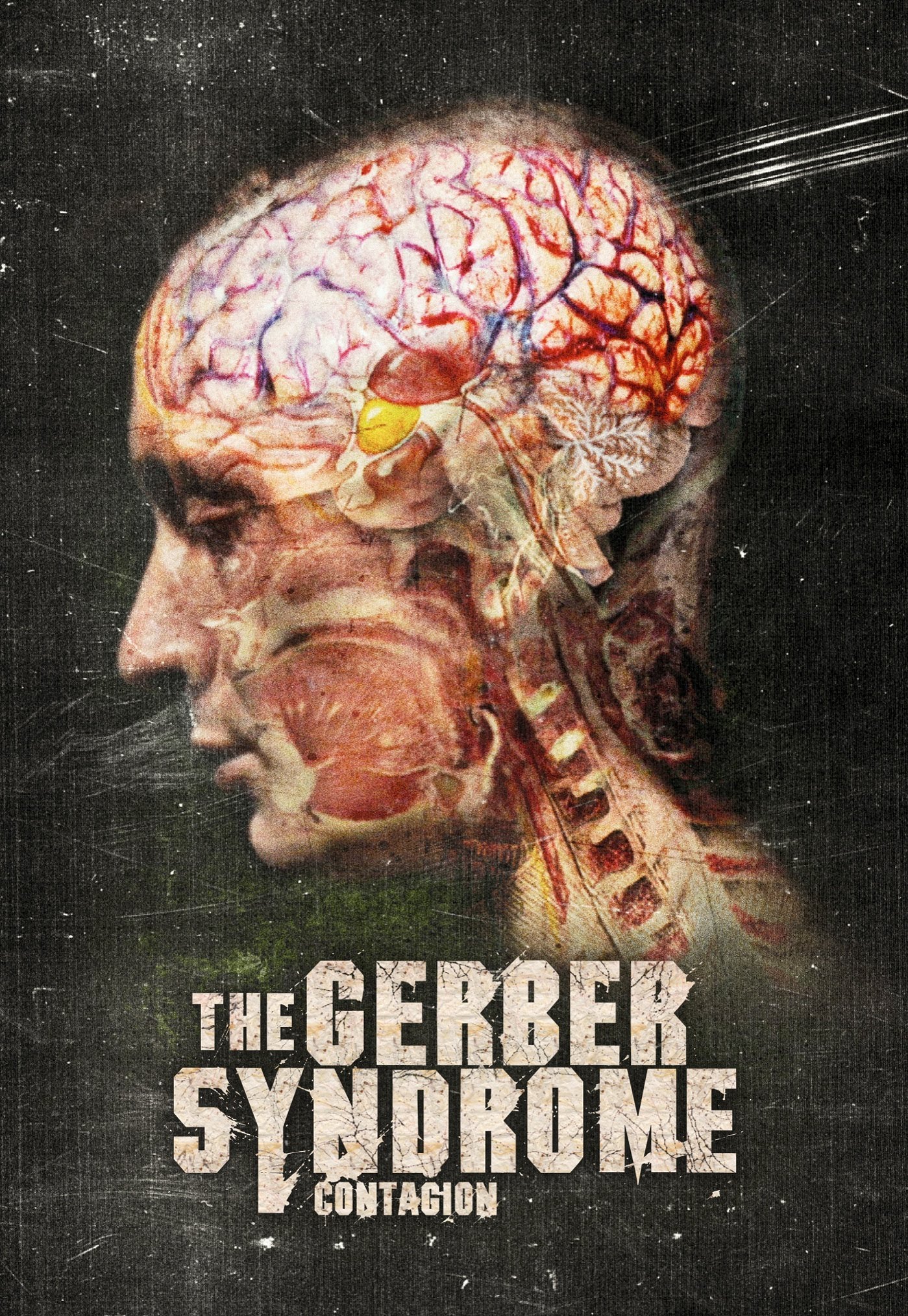 The Gerber Syndrome – Il contagio (2011)